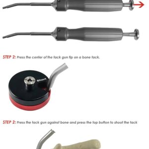 TBM-05 Titanium Membrane Shaping Kit – Auto Bone Tac Mini Set