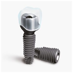 Chân răng nhân tạo UF(II) Fixture (Implant DIO)